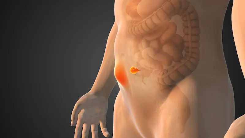 Umbilical Hernia Recovery